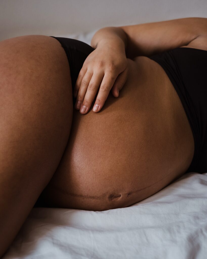Black maternal health